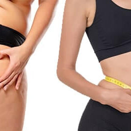 ¿qué es la celulitis? ¿Y como se puede prevenir?